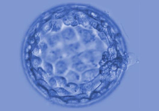 microscope image of a spherical blastocyst--membrane enclosing a few cells that form an early embryo