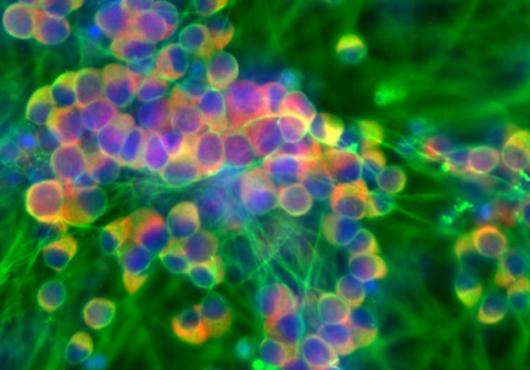 microscope image shows rainbow-tinted tubular cells connected by a network of filaments