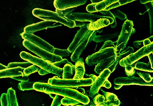 Rod-shaped Mycobacterium tuberculosis, the bacterium that causes TB, glowing green against a dark background in a scanning electron micrograph.