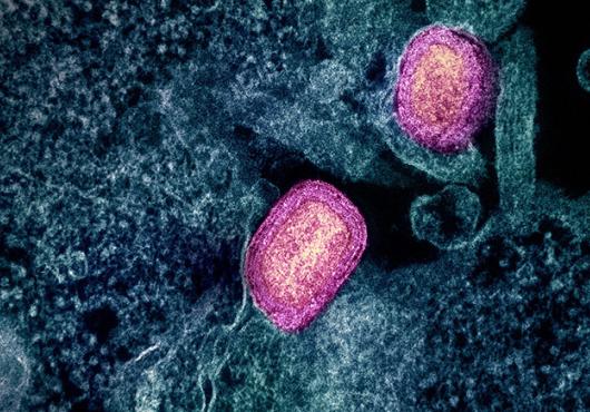 Colorized scanning electron micrograph shows two bright ovals against a webby cell-surface backdrop