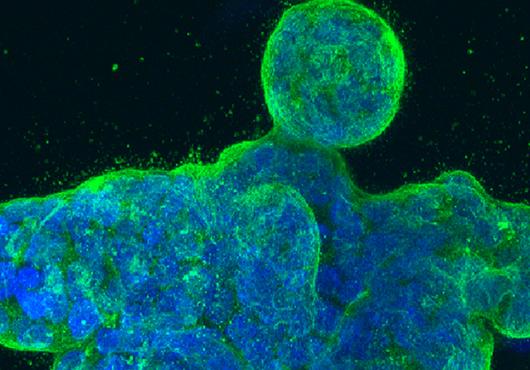 a blobby cluster of cancer cells glows blue with green edges under a microscope