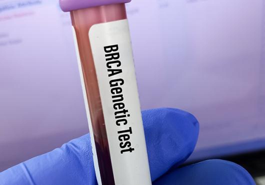 A vial of blood labeled BRCA genetic test