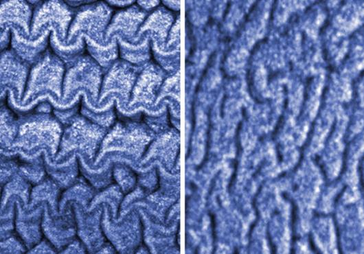 Side-by-side images show different patterns under a microscope. One is more condensed and crinkled in rows, while the other has flatter whorls like the surface of a brain.