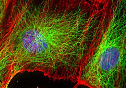 Microscope image of fluorescent human cells