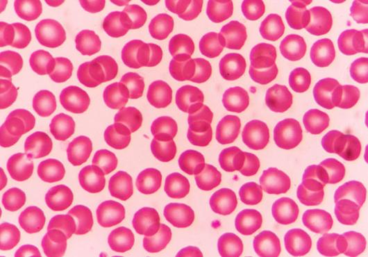 Red blood cells appear as dozens of spheres under a microscope