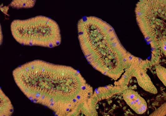 A cross-section of intestinal lining appears like irregular ovals with complex cell structures, shown in brown with green rings and occasional purple cells