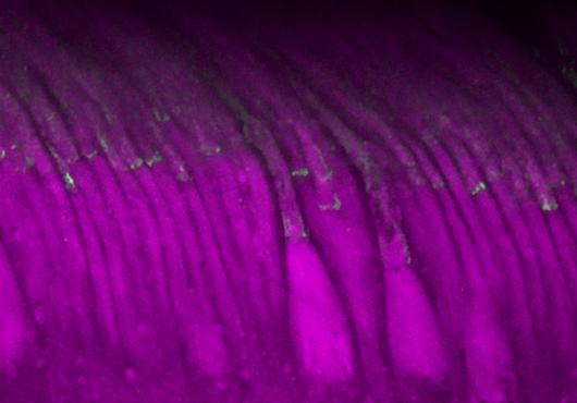 Cells in a row under a microscope have wider bases and long tails bending slightly to the left like reeds in a breeze. Each cell is fluorescently tagged purple with a dot of green about halfway up.