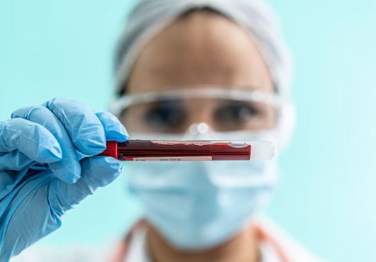 A person wearing protective gloves, glasses, and mask holds a small vial containing a blood sample.