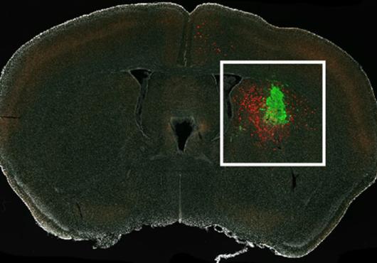 Cross-section of a mouse brain under a microscope shows a cluster of glioma cells tagged in green and connected neurons shown in red, concentrated around the glioma but also stretching from other areas of the brain.