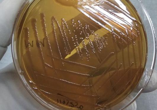A gloved hand holds a Petri dish with bacteria growing in it