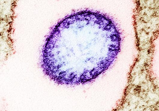 A purple circular Nipah virus particle floats in a field of pink surrounded by brown VERO cells.