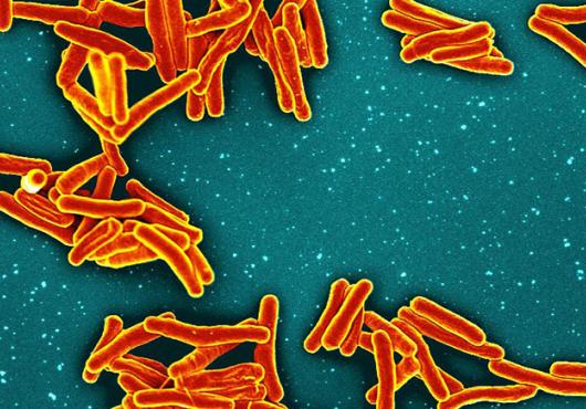 The germs that cause tuberculosis appear as clumps of red and yellow rod-shaped particles on a jade-green background.