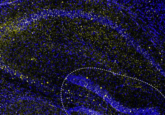 microscope image shows blue swirls with clusters of yellow dots against a black background