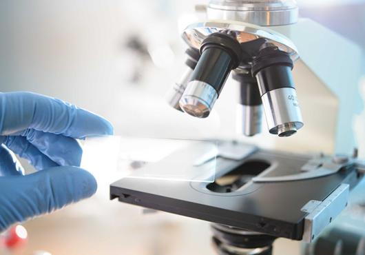 A gloved hand placing a glass microscope slide onto the stage of a compound microscope, with objective lenses in view, in a laboratory setting.
