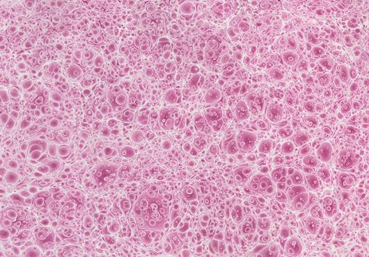 A sheet of textured paper with a pattern that appears to be dense, small, pink bubbles or cells.