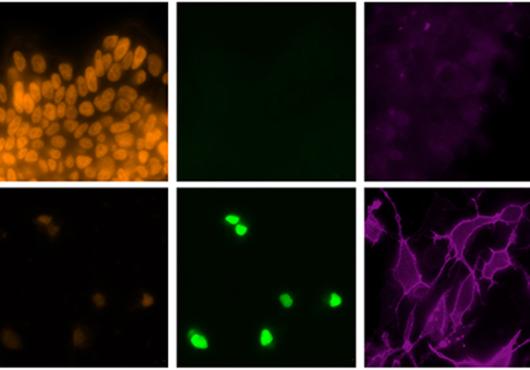 Top row: Untreated stem cells contain a protein (orange) marking its ability to mature into many different kinds of cells. Bottom row: Stem cells given a cocktail of transcription factors to coax them to become microglia-like cells express an array of proteins characteristic of human microglia. Images: Wyss Institute