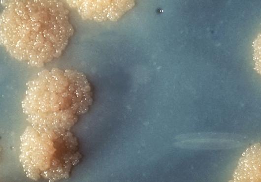 Close-up image of Mycobacterium tuberculosis bacterial colonies growing on a solid nutrient medium. The colonies appear rough, irregular, buff-colored, and bubbly, resembling small cauliflower-like clusters on a blue-gray background.