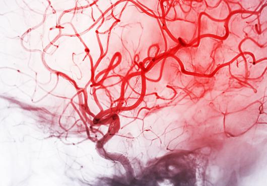 A network of thin red lines on skull-shaped gray background