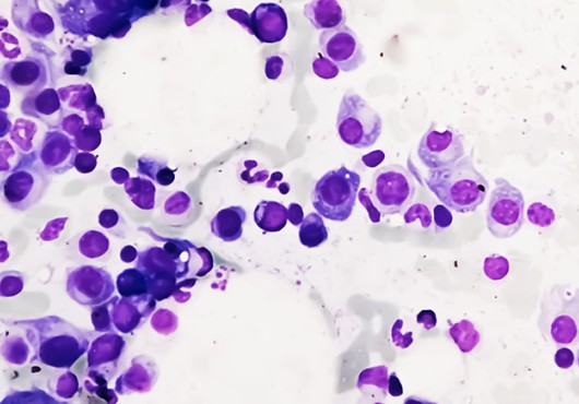 Clusters of purple circles on a white background