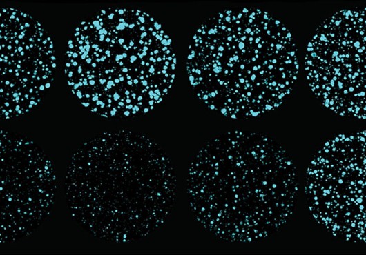 Eight circular views under a microscope of clusters of cells, ranging from sparse to dense