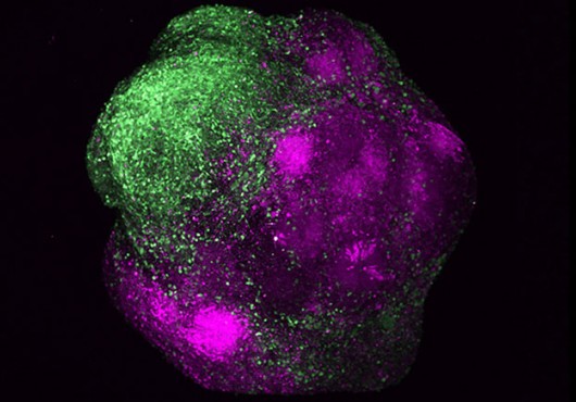 A ball-like structure under a microscope. One side is mostly green and the other mostly magenta.