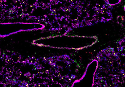 Cross-section of lung tissue shows 6 structures with bright pink outlines and hollow middles, amid purple, green, yellow, and blue dots like a starfield.