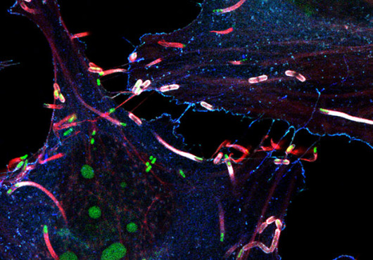 Fluorescence microscopy image of cultured cells showing green listeria trailing red comet tails of actin filaments. The background is black, making the brightly colored bacteria and cellular structures stand out vividly.