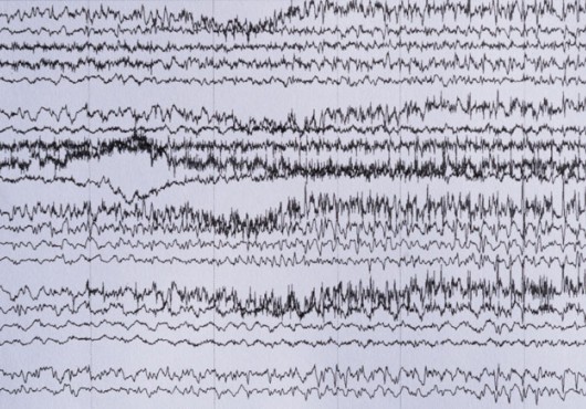 A series of irregularly spiky, black horizontal lines on a white background