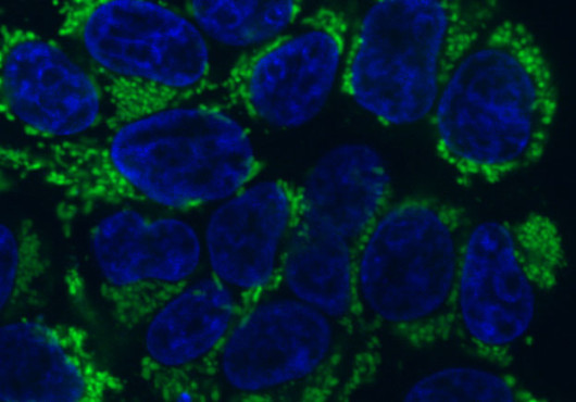 A microscope imaging showing a cluster of round blue shapes surrounded by bright green and black