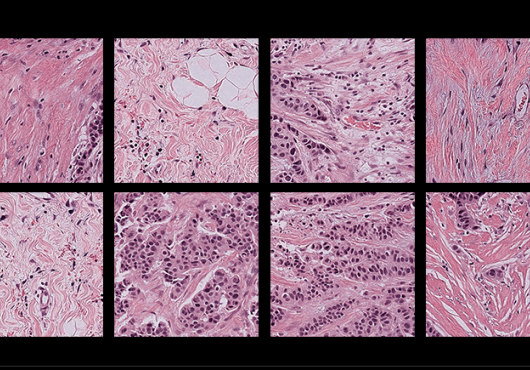 Two rows of four pink and purple microscope images with a black border