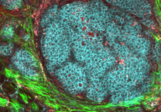 A round cluster of blue cells surrounded by bright green and dark red tissue