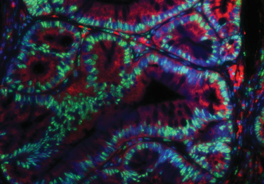 Swirls of cells lit up in green, blue, and red