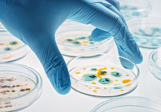 A blue-gloved hand places a petri dish with blue and yellow cultures on a transparent table with other petri dishes