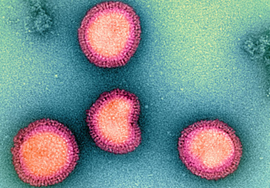 Four influenza particles appear as studded spheres, one indented like a kidney bean. The image has been artificially colored so the particles stand out against the background of a petri dish.