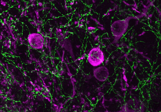 Microscopic view of brain cells shows a matrix of spindly green axons and round magenta cell bodies.