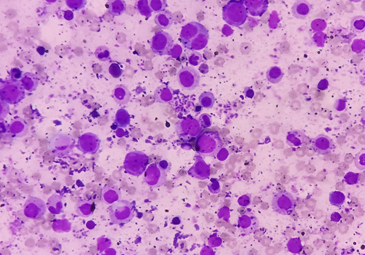 Microscopic image showing numerous purple-stained cells of varying sizes scattered across a pale pink background.