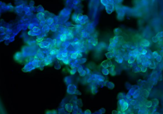 Seen through a microscope, placental villi are fluorescently stained green, cyan, and blue.