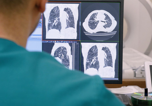 A radiologist in a green shirt looks at a screen showing four images of CT lung scans; a white CT scanner appears blurred in the background. 