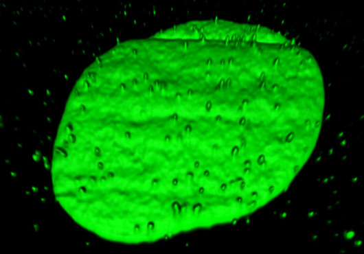 Glowing green blobs of DNA emerging from the nucleus of a human cell in a lab dish.