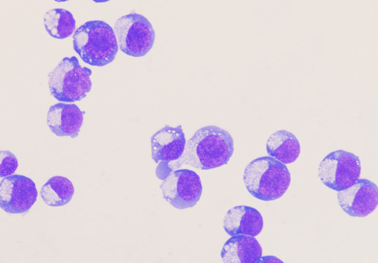 About two dozen cells are seen under a microscope. Part of each cell is stained purple like a half-moon.