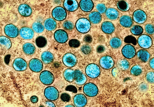 Teal-colored, speckled speres in a textured brown background.