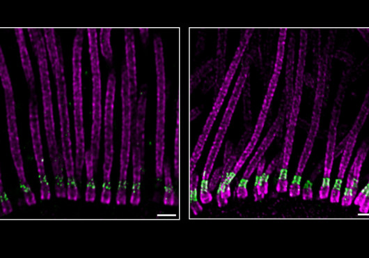 Two collections of about 10 fluorescently labeled cilia under a microscope look like long parallel strands with a short green cuff toward the bottom end.