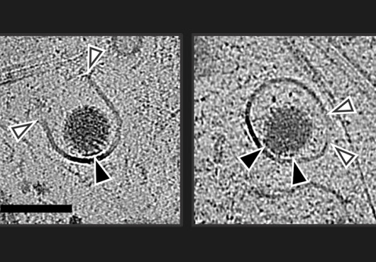 Cryo-electron microscopy views of a round rotavirus enclosed in a membrane-bound compartment. White arrows indicate where viral proteins have created an opening in the membrane.