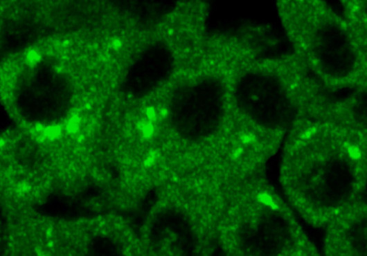 Microscopic image of cells, in green against a black background, many with small, bright fluorescent spots.