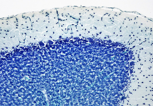 Stained cross-section of the cerebellum with Purkinje cells visible