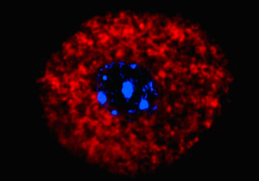 Microscope image of neurons after allergen exposure.