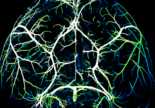 circle of willis
