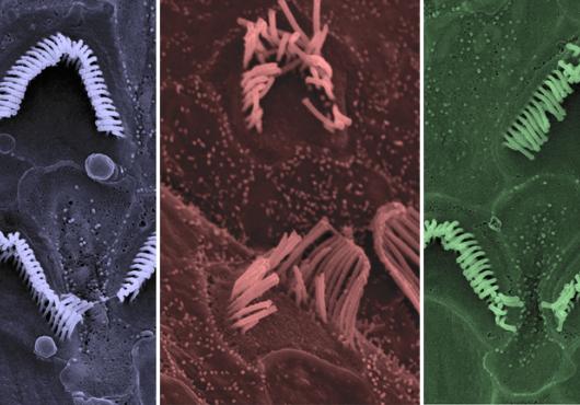 hearing cells