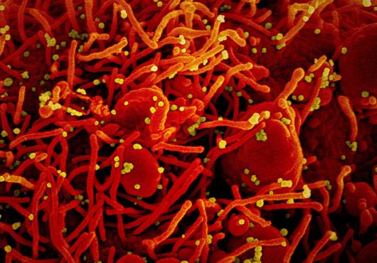 Colorized micrograph has dozens of yellow specks stuck to a textured red cell surface