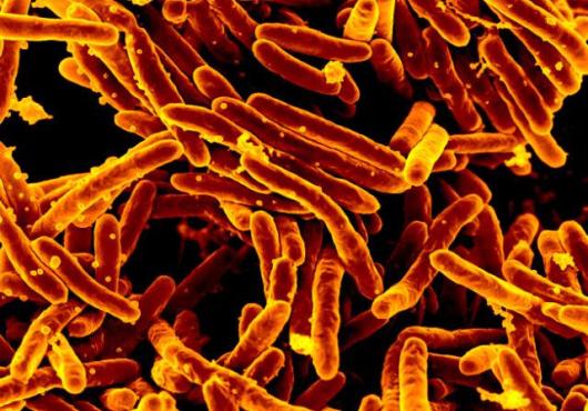 DiaMOND in the Rough